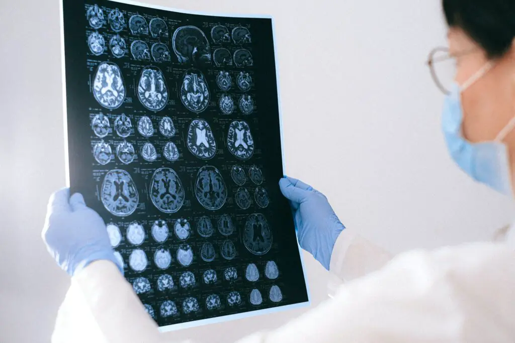 Salaries For Brain Surgeon